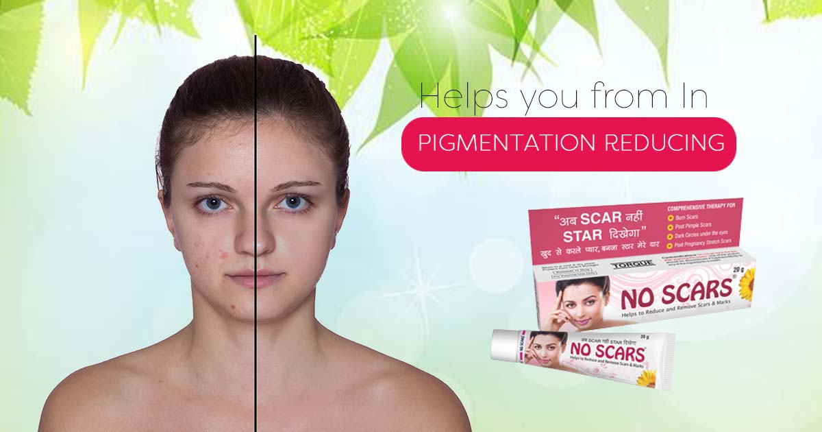 Best creams to treat acne scar